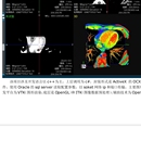 MPR三视图阅片系统