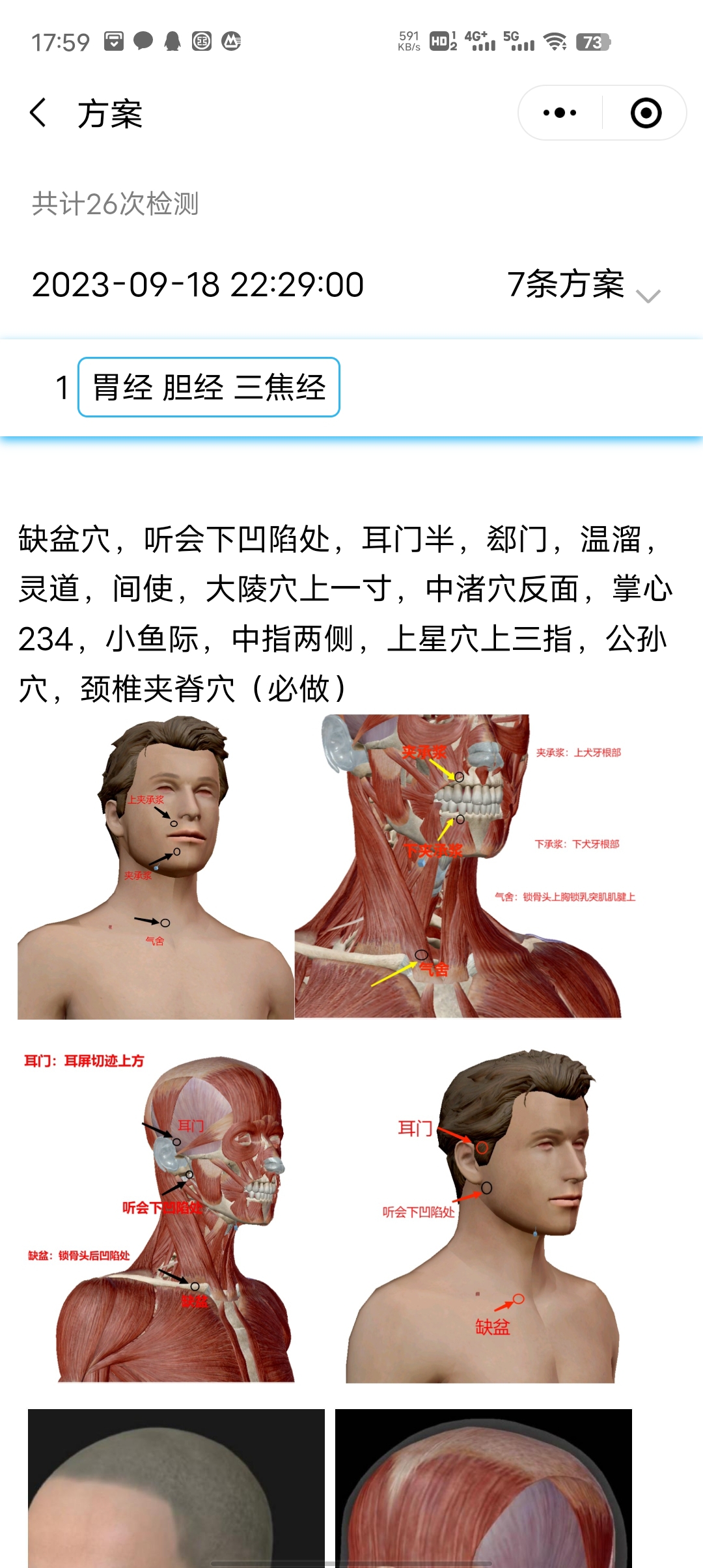 链接图片